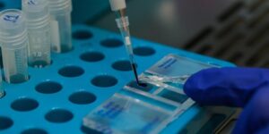 KKKA aşısı için klinik öncesi çalışmalarda sona gelindi